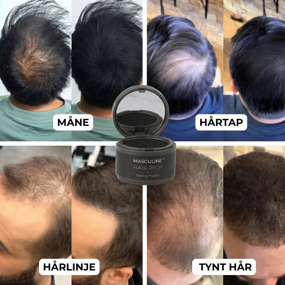 Masculine HairRich™ - Premium-Haarausfall-Filler für Männer